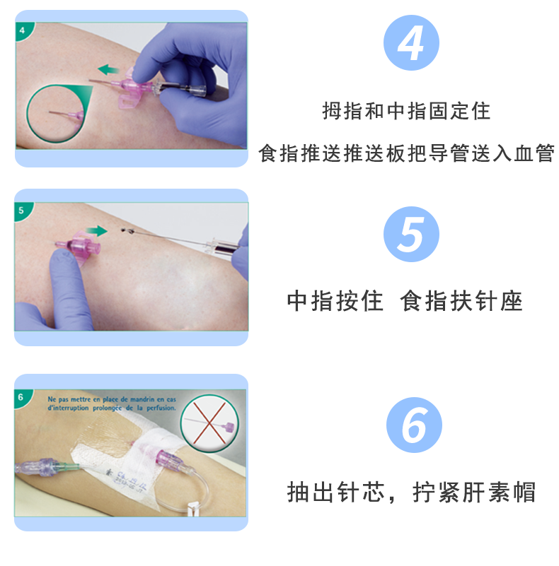 德國貝朗 Introcan-W 英初康 動(dòng)靜脈留置針（帶翼） 