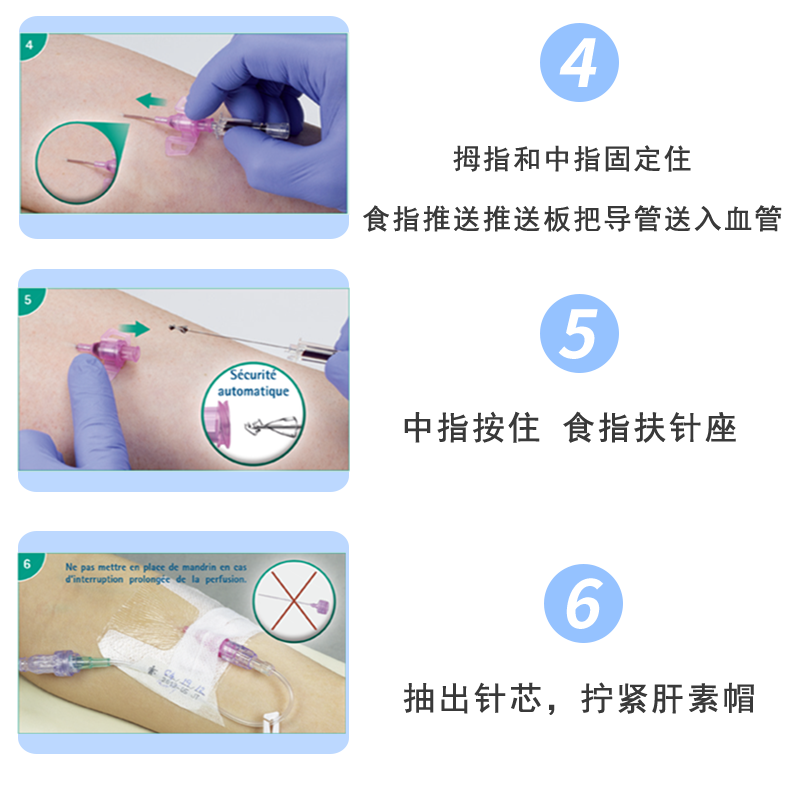 英全康22G動(dòng)靜脈留置針