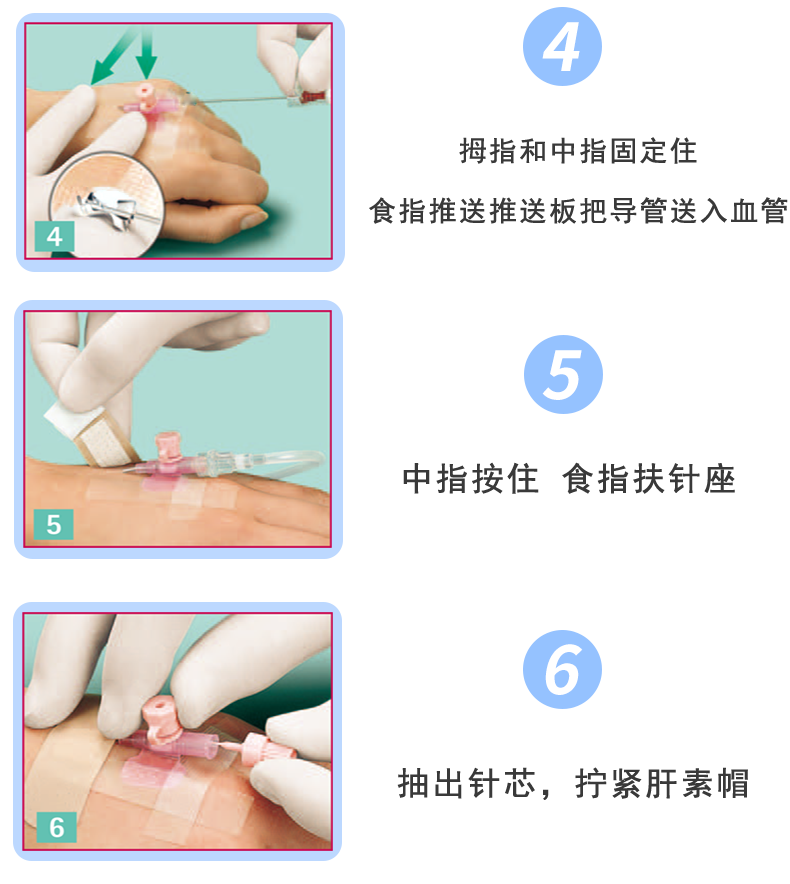 德國(guó)貝朗 靜脈留置針 Vasofix沃素菲